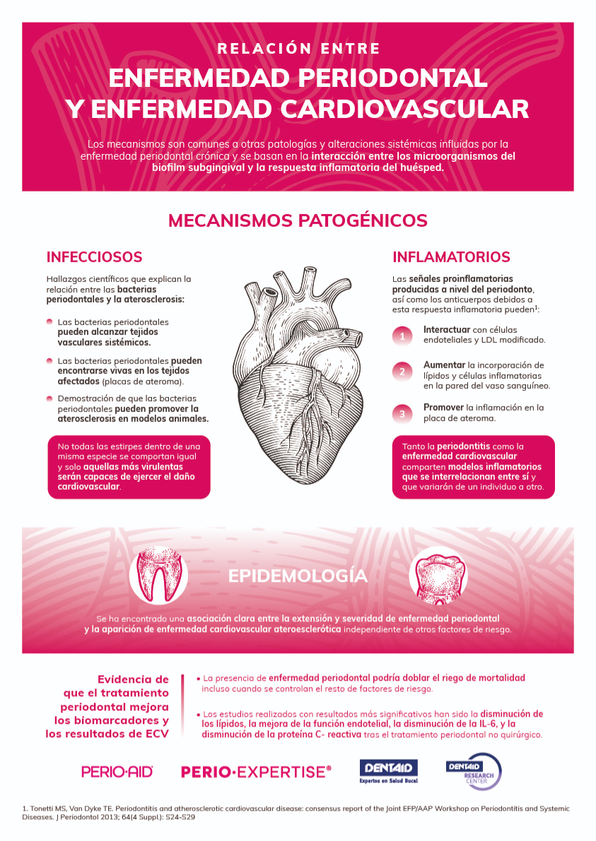 Relación entre enfermedad periodontal y enfermedad cardiovascular